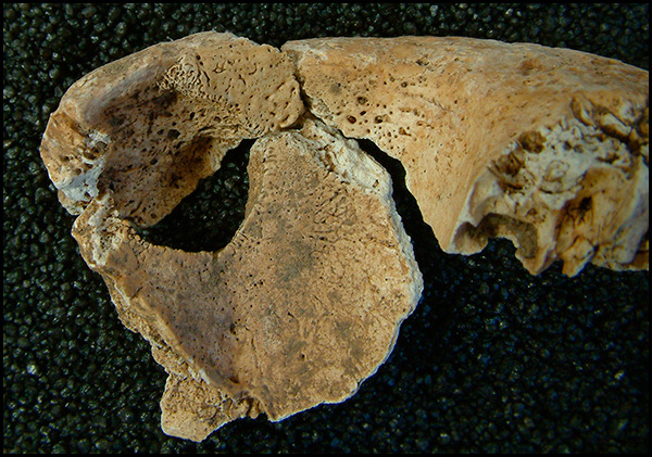 Photograph of a some human childs bone