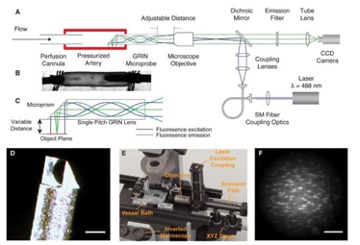 Vascular imaging system for viewing inside intact arteries.