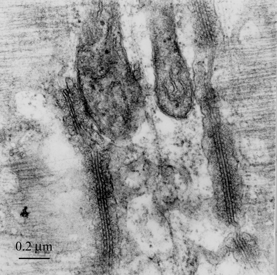 Electron micrograph image showing internal membranous structures deep within the substance of a skeletal muscle fibre, courtesy of Dr R W Banks.