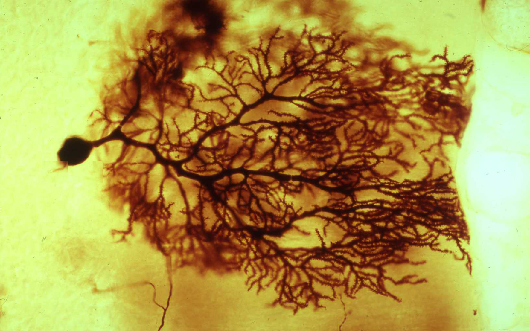 Microscopy image of a nerve cell, or neuron, from the cortex of the cerebellum, courtesy of Dr R W Banks.